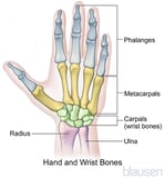 Hand and finger deformities