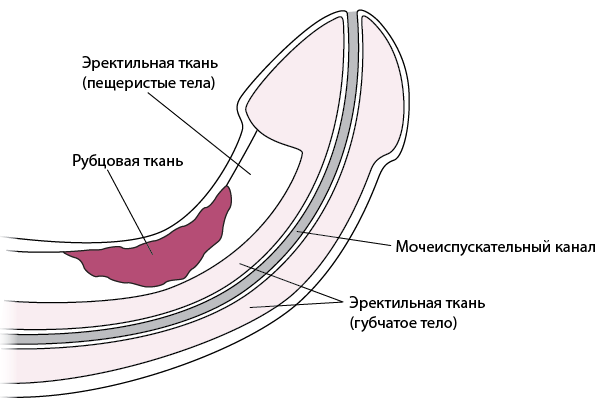 Кішкентай пенис біреуді пәктіктен айыруы мүмкін.
