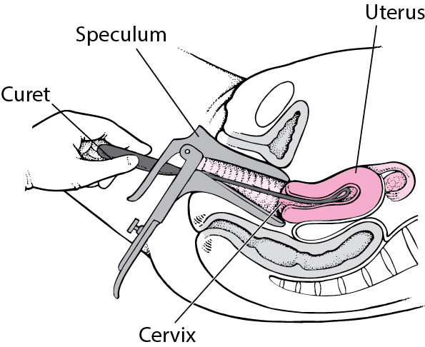 Yalangoch Kylie Bucks
