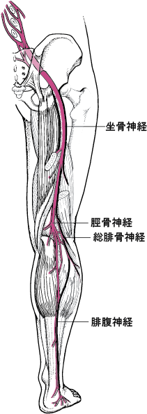 坐骨神経痛 - 08. 骨、関節、筋肉の病気 - MSDマニュアル家庭版
