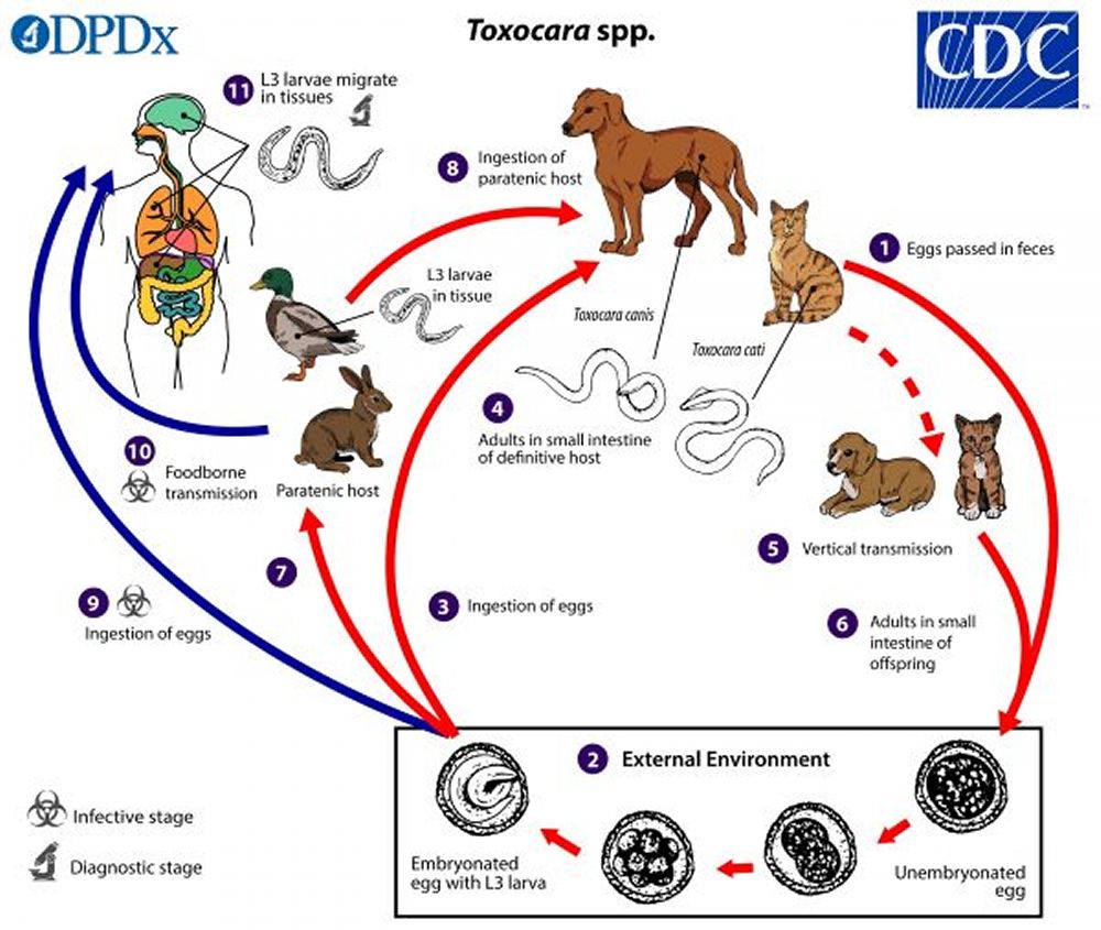 Toxocaríase - Infecções - Manual MSD Versão Saúde para a Família, image size:1000x845