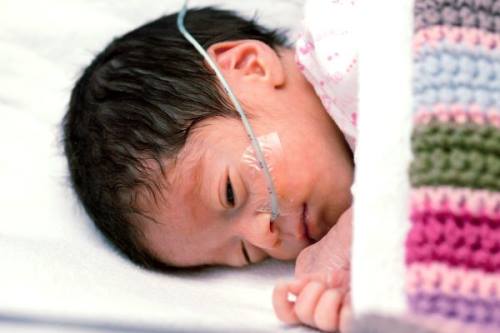 Commentary: Nirsevimab Prevents Bronchiolitis in Premature Infants