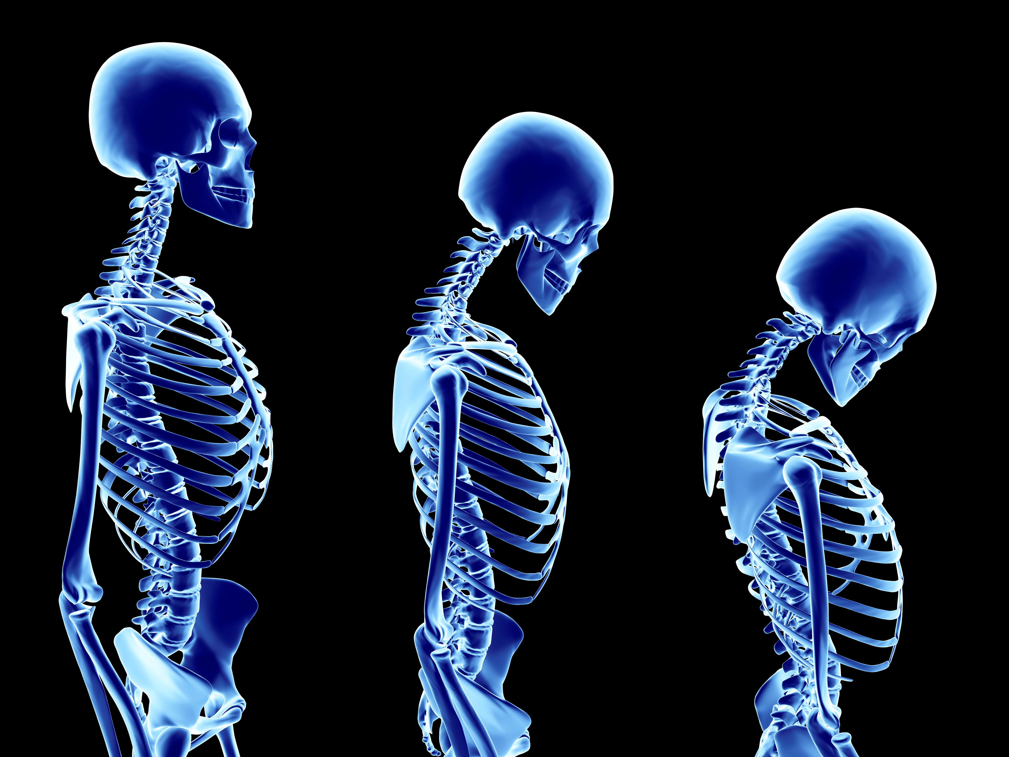 Three skeletons gradually slouching