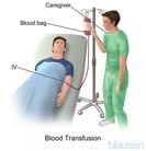 Overview of Blood Transfusion