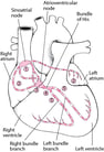 Overview of Heart Block
