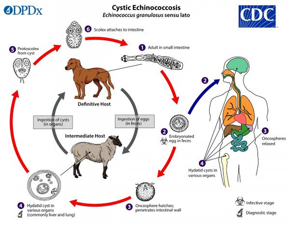 Image: Life Cycle of Echinococcus (Dog Tapeworm) - MSD Manual Consumer  Version