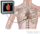 Echocardiography and Other Ultrasound Procedures