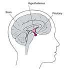 Overview of the Pituitary Gland