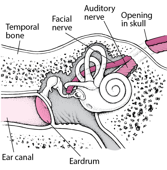 Temporal Bone