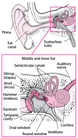 Overview of Middle Ear Infections in Young Children