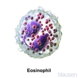 High number of eosinophils