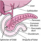 Overview of Pancreatitis