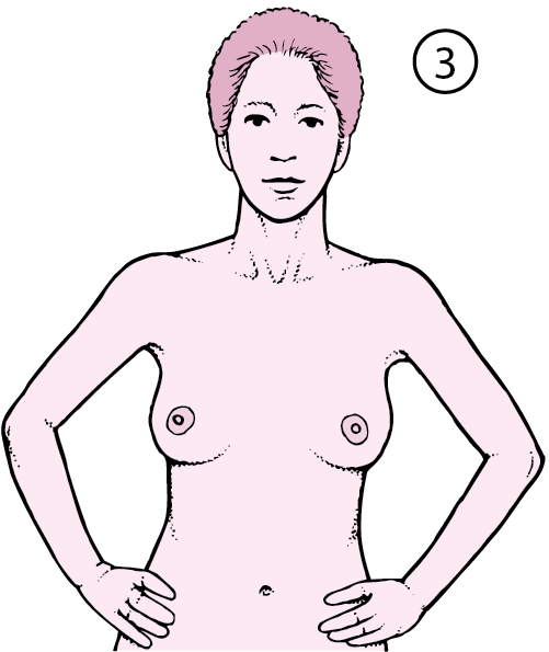 How to Do a Breast Self-Examination