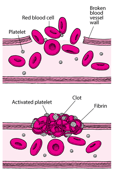 Blood Clots: Plugging the Breaks