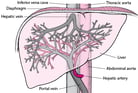 Overview of Blood Vessel Disorders of the Liver