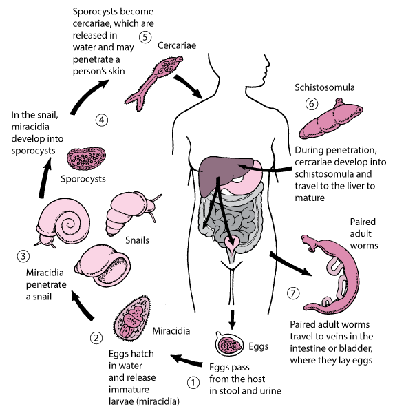 schistosomiasis diagnózis)