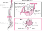 Overview of Spinal Cord Disorders
