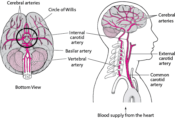 Overview of Stroke - Brain, Spinal Cord, and Nerve Disorders - MSD Manual Consumer Version