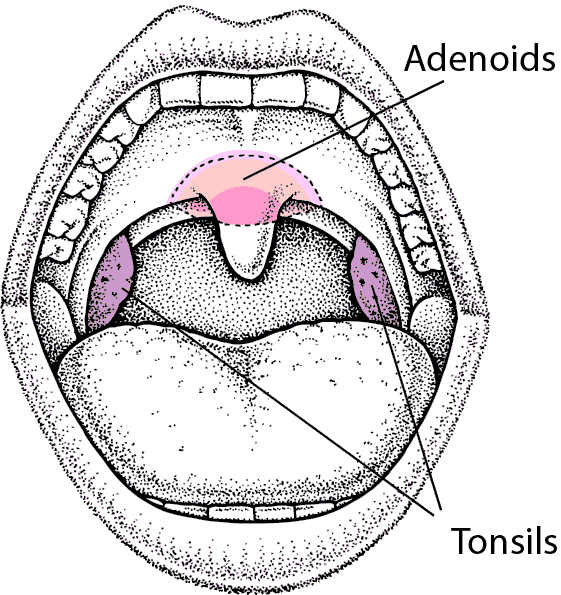 Locating the Tonsils and Adenoids