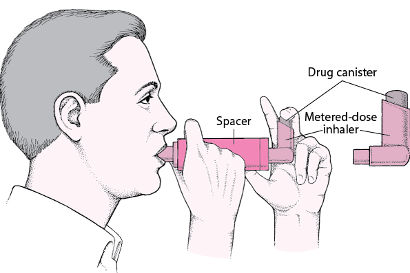 How to Use a Metered-Dose Inhaler With a Spacer