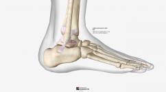 Esguinces y distensiones (tirones)