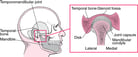 Overview of Temporomandibular Disorders (TMD)