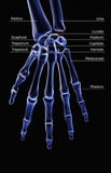 Nerve compression syndromes of the hand