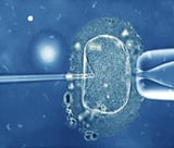 Assisted Reproductive Techniques