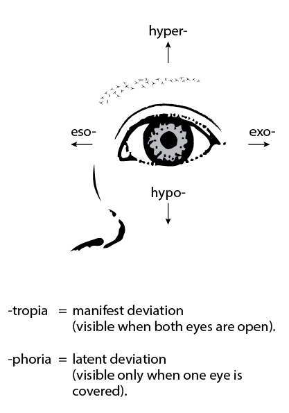 Ocular deviations in strabismus