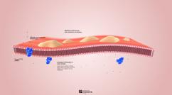 Fibrosis quística: defecto del transporte de cloruro