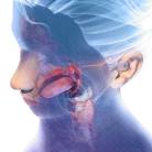 Maladie de Ménière