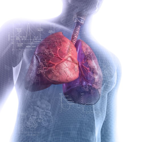 Overview of Environmental Lung Diseases