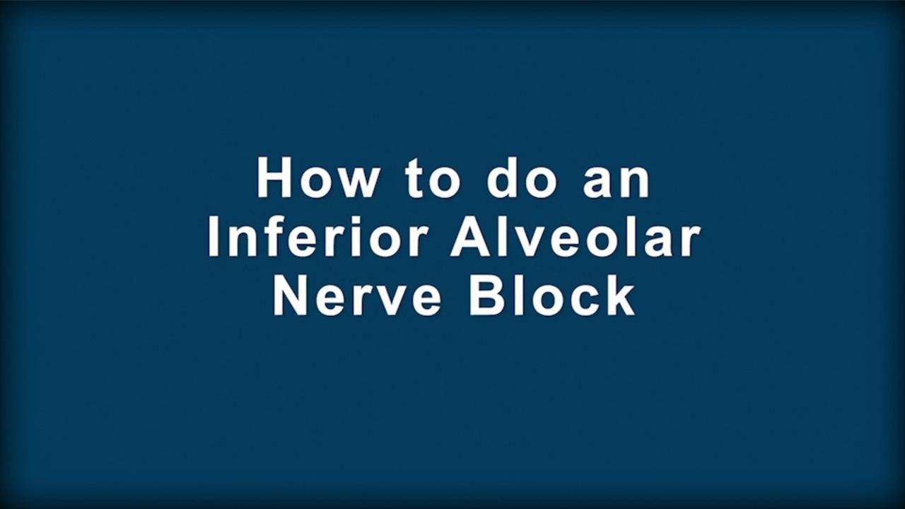 Come eseguire un blocco del nervo alveolare inferiore