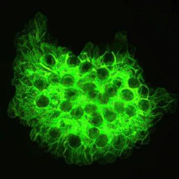 Colorazione fluorescente (Pneumocystis jirovecii)