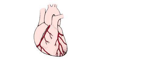Depositi lipidici in un’arteria coronaria