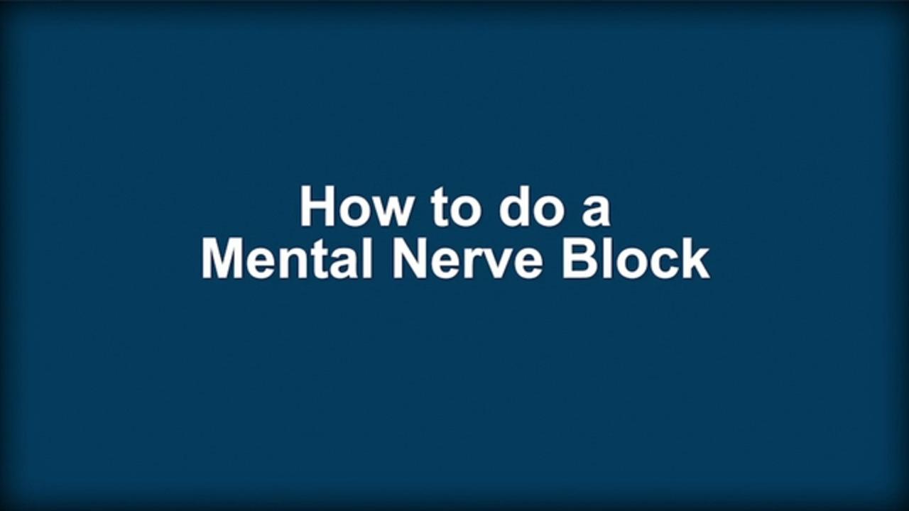 Come eseguire un blocco del nervo mentoniero