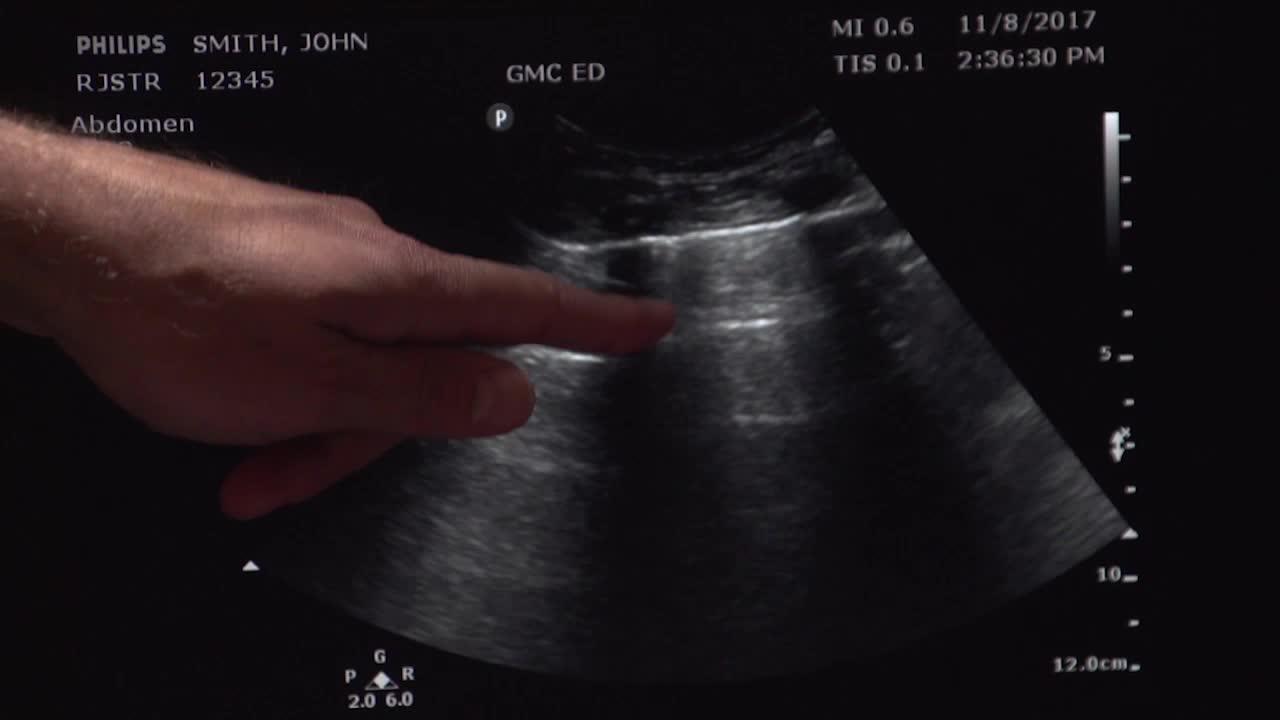 Como fazer ultrassonografia: console e controles