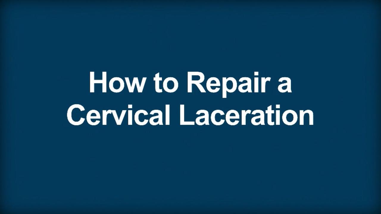 How to Repair a Cervical Laceration