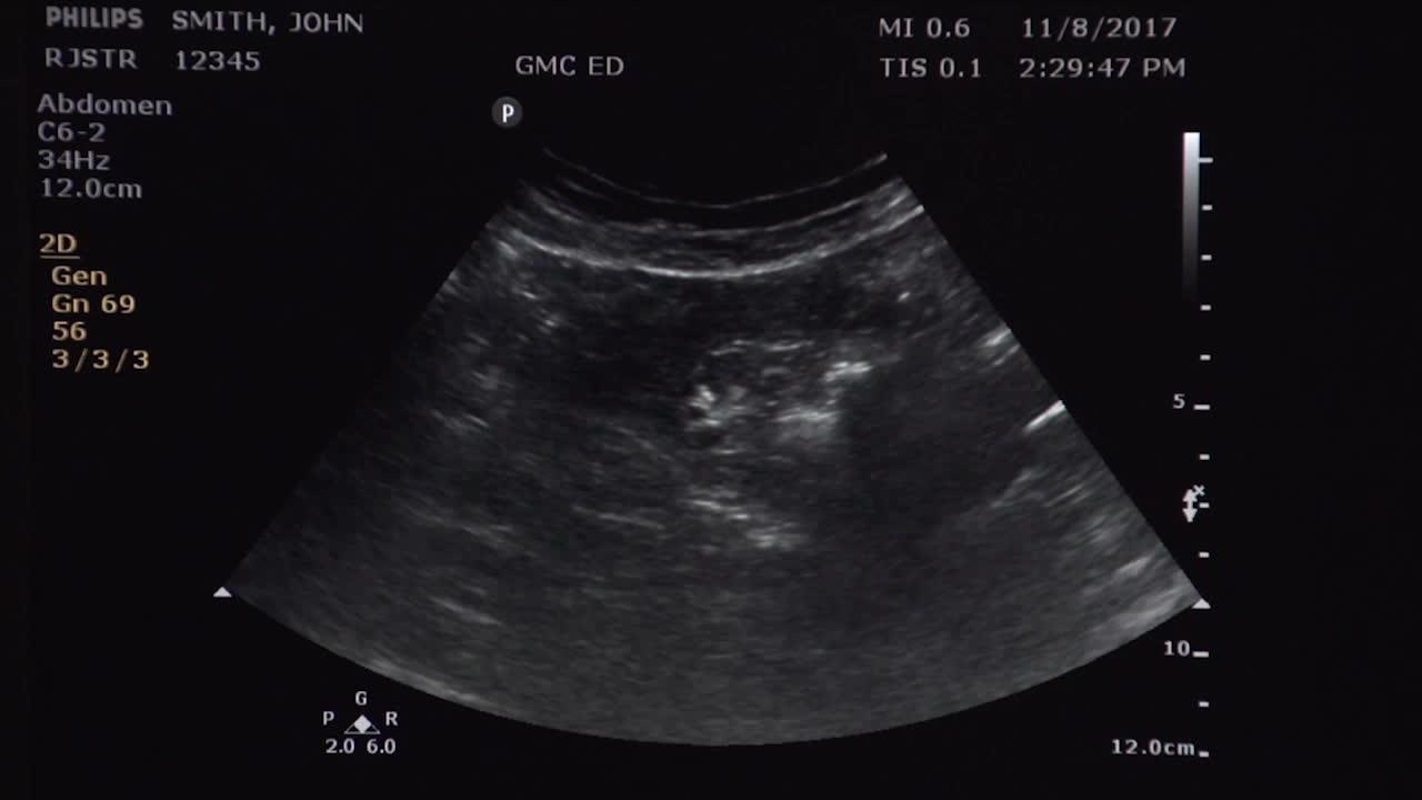 Como fazer ultrassonografia: obtendo imagens