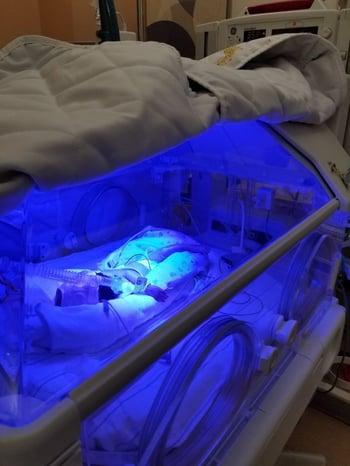 Фототерапия или «светолечение при желтухе новорожденных»