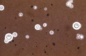 Окраска индийскими чернилами (Cryptococcus neoformans)